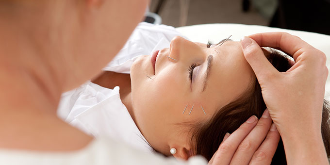 Acupuncture Treatment Grimsby Ontario