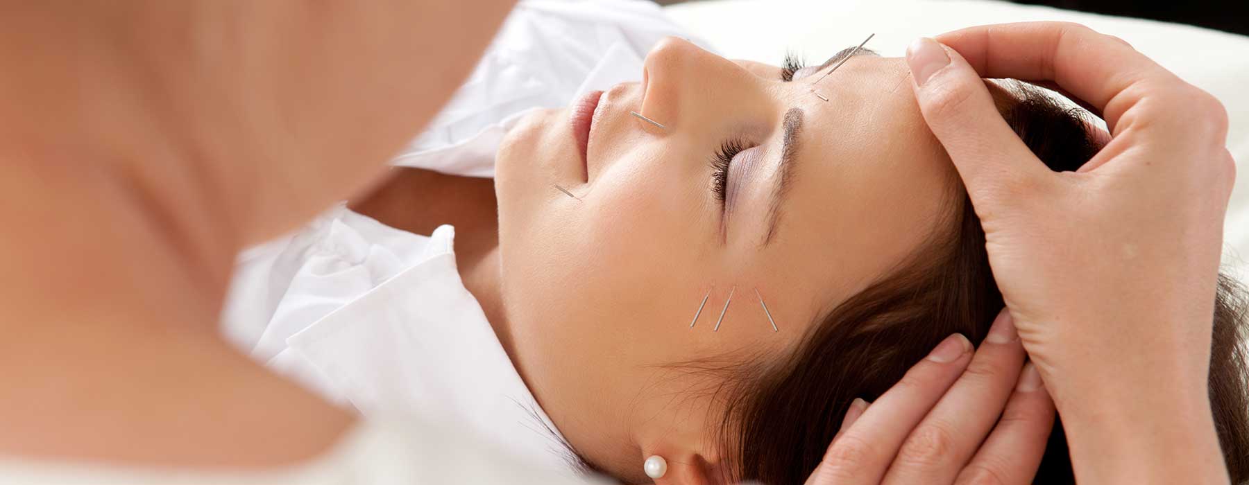 Free Acupuncture Treatment